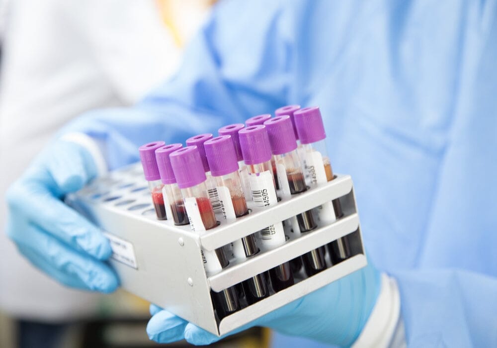 Perimenopause and Menopause Tests: All You Need To Know – The Better ...
